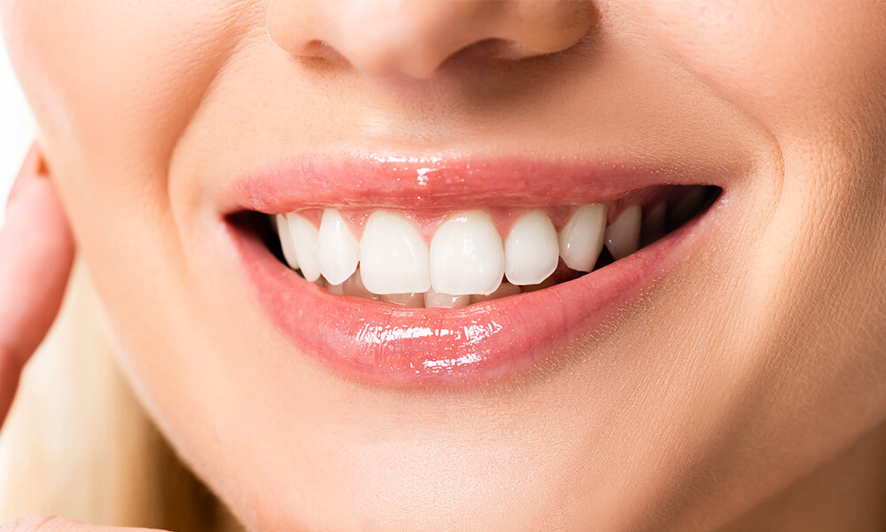 Teeth Whitening Services in Strongsville OH Area