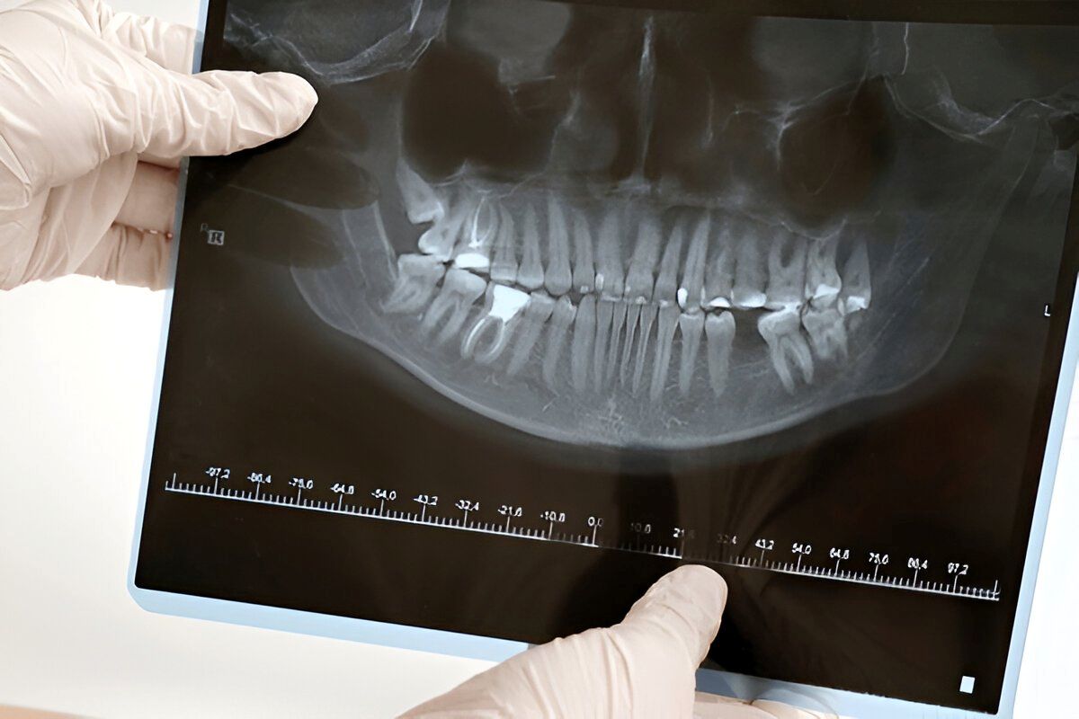 3D dental CT scans near you for accurate diagnosis and advanced treatment planning