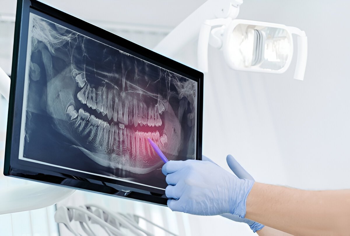 digital radiology in strongsville ohio