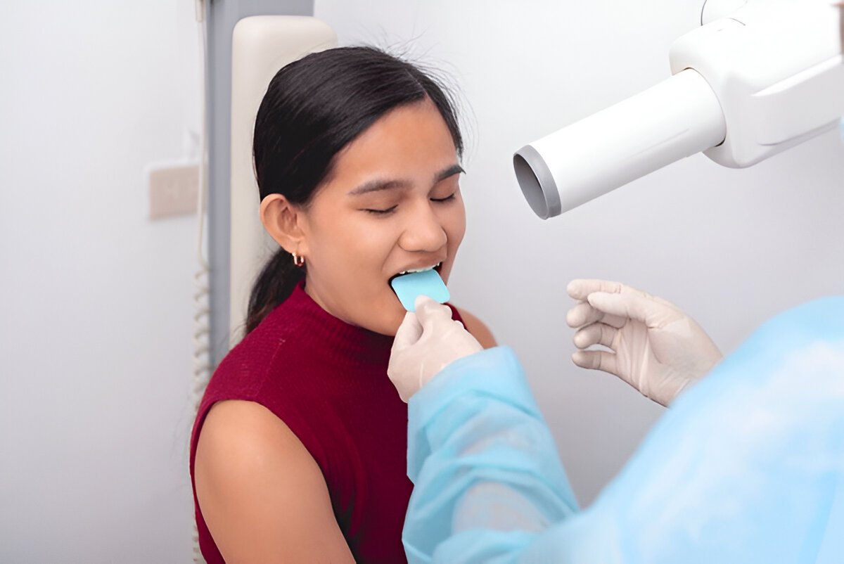 external bitewing x-ray near you