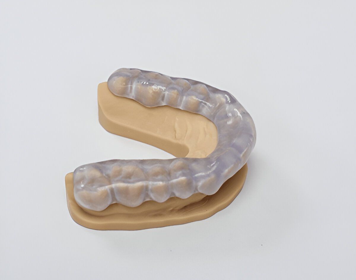 Custom night guards in Strongsville, Ohio to protect teeth from grinding and clenching