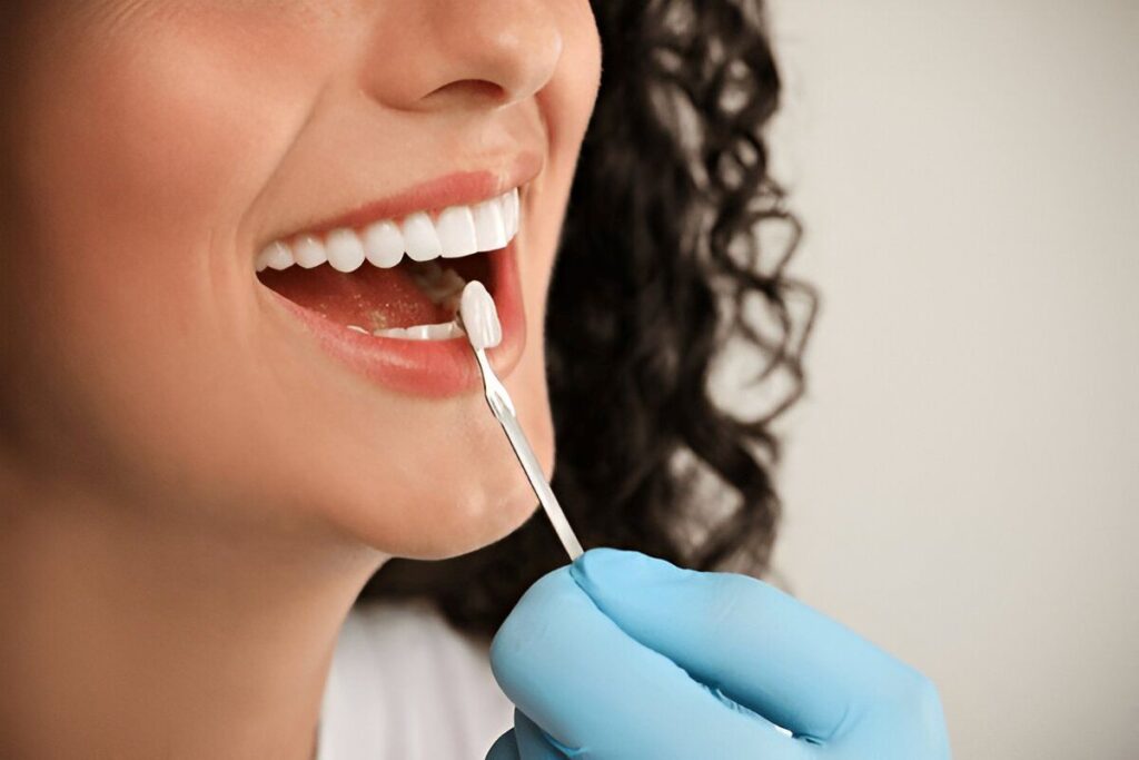 Same-day veneers near you