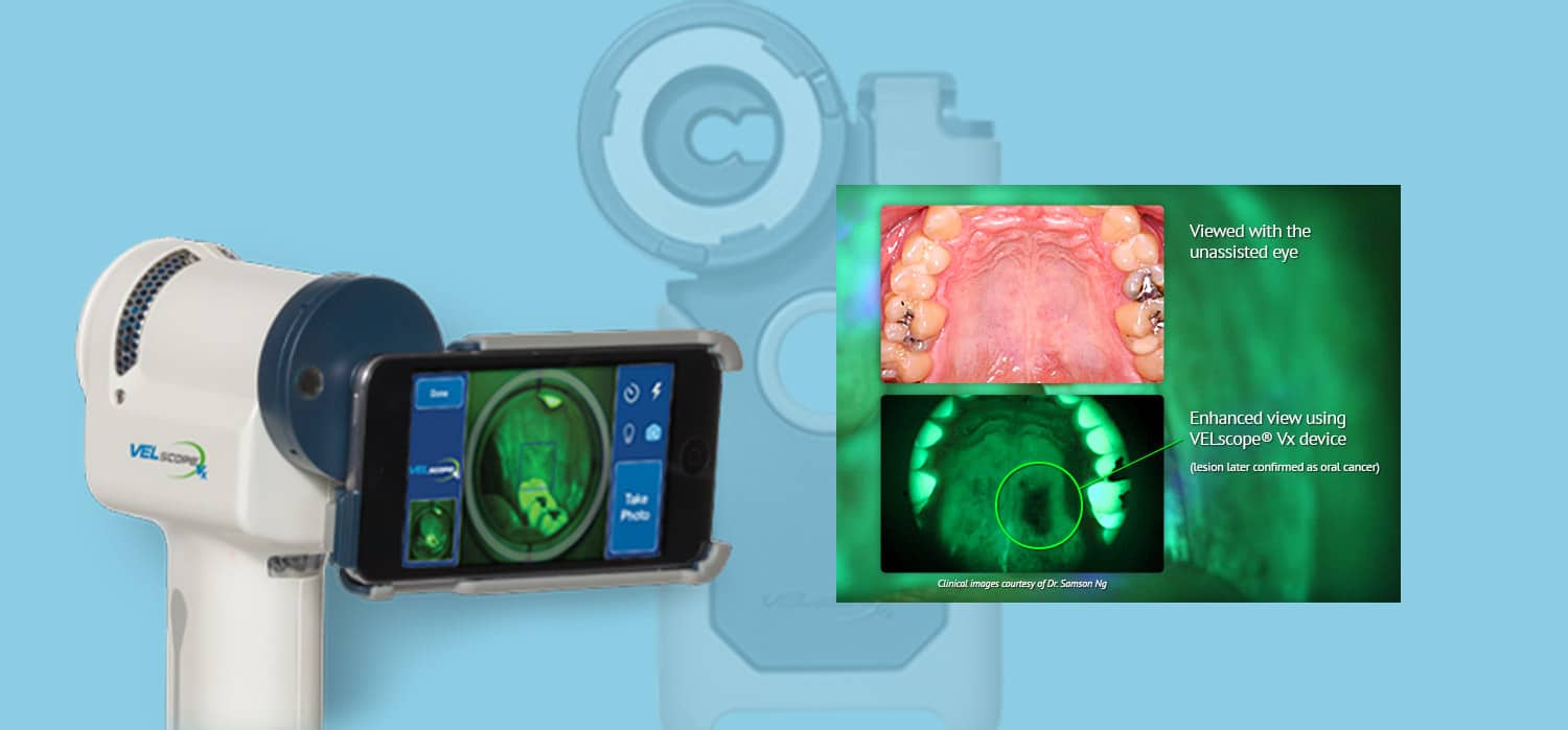 velscope in strongsville, ohio