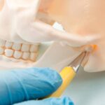 tmj treatment