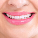 healthy teeth