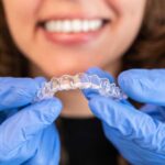 suresmile clear aligners