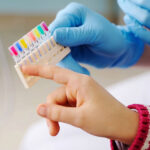 tooth color fillings