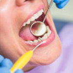 how-long-do-tooth-fillings-last-tips to-extend-their-life